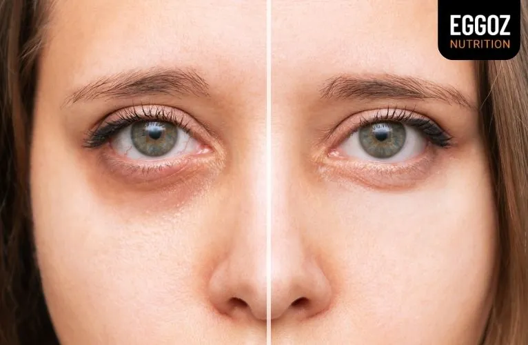 How to Remove Dark Circles From Photos Easily in 2024